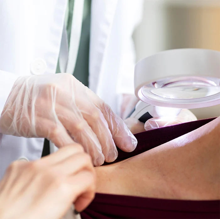 Scleredema Diabeticorum (Thick, Hard Skin)