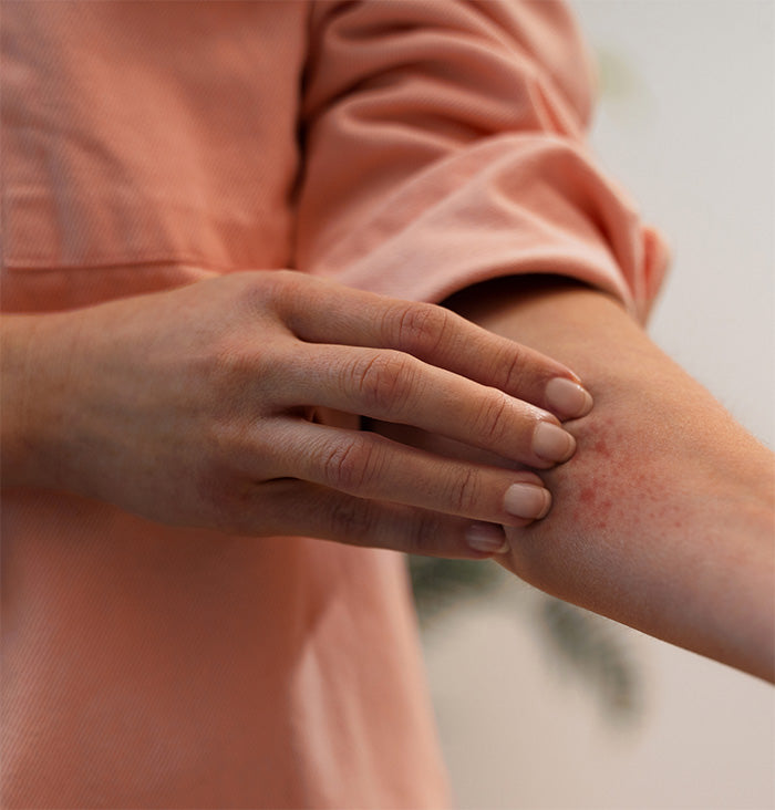 Candidiasis Diabetes Fungal Infections